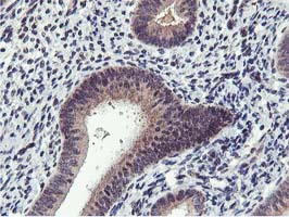 MIER2 Antibody - IHC of paraffin-embedded Human endometrium tissue using anti-MIER2 mouse monoclonal antibody. (Heat-induced epitope retrieval by 10mM citric buffer, pH6.0, 100C for 10min).