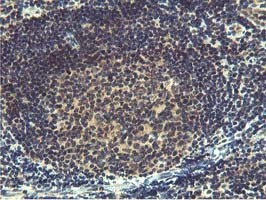 MIER2 Antibody - IHC of paraffin-embedded Human tonsil using anti-MIER2 mouse monoclonal antibody. (Heat-induced epitope retrieval by 10mM citric buffer, pH6.0, 100C for 10min).