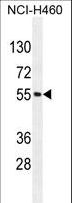 MIER2 Antibody - MIER2 Antibody western blot of NCI-H460 cell line lysates (35 ug/lane). The MIER2 antibody detected the MIER2 protein (arrow).