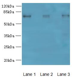 MIER2 Antibody - Western blot. All lanes: MIER2 antibody at 4 ug/ml. Lane 1: Jurkat whole cell lysate. Lane 2: HepG-2 whole cell lysate. Lane 3: A549 whole cell lysate. Secondary Goat polyclonal to Rabbit IgG at 1:10000 dilution. Predicted band size: 60 kDa. Observed band size: 60 kDa.
