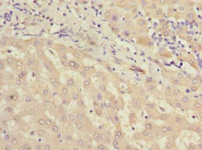 MIER2 Antibody - Immunohistochemistry of paraffin-embedded human liver tissue using antibody at dilution of 1:100.