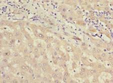 MIER2 Antibody - Immunohistochemistry of paraffin-embedded human liver tissue using antibody at dilution of 1:100.