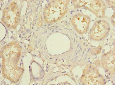 MIER2 Antibody - Immunohistochemistry of paraffin-embedded human kidney tissue using MIER2 Antibody at dilution of 1:100