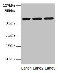 MIER2 Antibody - Western blot All lanes: MIER2 antibody at 4µg/ml Lane 1: Jurkat whole cell lysate Lane 2: HepG2 whole cell lysate Lane 3: A549 whole cell lysate Secondary Goat polyclonal to rabbit IgG at 1/10000 dilution Predicted band size: 60 kDa Observed band size: 60 kDa