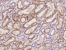MIER2 Antibody - Immunochemical staining of human MIER2 in human kidney with rabbit polyclonal antibody at 1:100 dilution, formalin-fixed paraffin embedded sections.