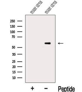 MIER3 Antibody - Western blot analysis of extracts of mouse uterus tissue using MIER3 antibody. The lane on the left was treated with blocking peptide.