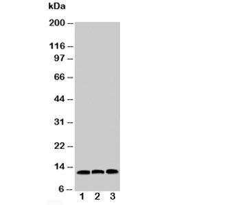 MIF Antibody - Western blot testing of MIF antibody and Lane 1: HeLa; 2: COLO320; 3: MM231 cell lysate