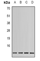 MIF Antibody - Western blot analysis of MIF expression in HEK293T (A); 22RV1 (B); HeLa (C); HepG2 (D) whole cell lysates.
