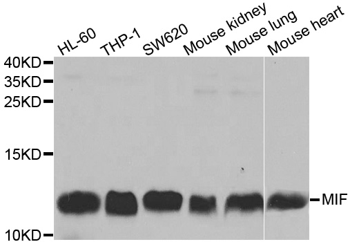 MIF Antibody - Western blot analysis of extracts of various cell lines, using MIF antibody at 1:1000 dilution. The secondary antibody used was an HRP Goat Anti-Rabbit IgG (H+L) at 1:10000 dilution. Lysates were loaded 25ug per lane and 3% nonfat dry milk in TBST was used for blocking.