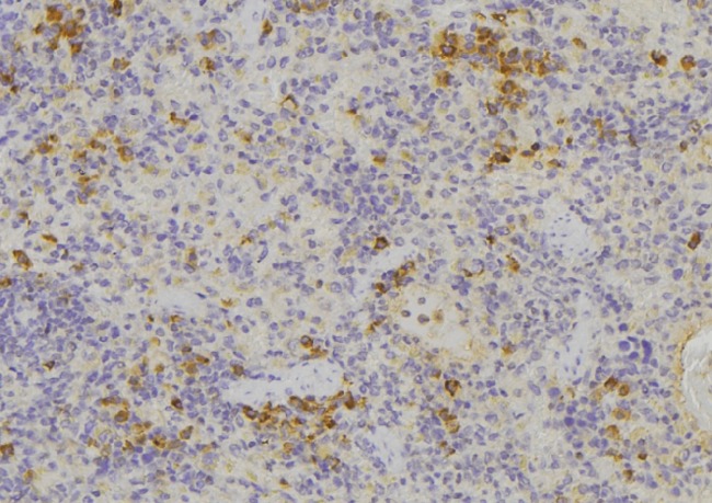 MIF Antibody - 1:100 staining human lymph node tissue by IHC-P. The sample was formaldehyde fixed and a heat mediated antigen retrieval step in citrate buffer was performed. The sample was then blocked and incubated with the antibody for 1.5 hours at 22°C. An HRP conjugated goat anti-rabbit antibody was used as the secondary.