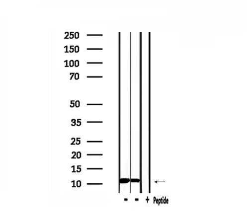 MIF Antibody - Western blot analysis of extracts of HeLa and 293 cells using MIF antibody.
