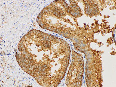 MIF Antibody - Immunohistochemistry of paraffin-embedded Human prostate using MIF Polycloanl Antibody at dilution of 1:50