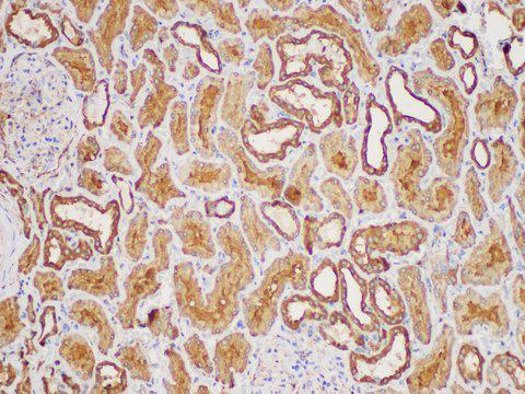 MIF Antibody - Immunohistochemistry of paraffin-embedded Human kidney using MIF Polycloanl Antibody at dilution of 1:50
