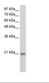 MIF4GD Antibody - HepG2 Cell Lysate.  This image was taken for the unconjugated form of this product. Other forms have not been tested.
