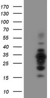 MIF4GD Antibody - HEK293T cells were transfected with the pCMV6-ENTRY control (Left lane) or pCMV6-ENTRY MIF4GD (Right lane) cDNA for 48 hrs and lysed. Equivalent amounts of cell lysates (5 ug per lane) were separated by SDS-PAGE and immunoblotted with anti-MIF4GD.