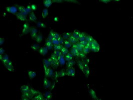 MIF4GD Antibody - Immunofluorescent staining of HeLa cells using anti-MIF4GD mouse monoclonal antibody.
