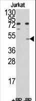 MINA / MINA53 Antibody - Western blot of anti-MINA antibody pre-incubated with and without blocking peptide (BP)(catalog #:BP1033b) in Jurkat cell line lysate. MINA(arrow) was detected using the purified antibody.