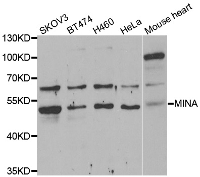 MINA / MINA53 Antibody - Western blot analysis of extracts of various cell lines.