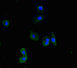 MINA / MINA53 Antibody - Immunofluorescent analysis of HepG2 cells using MINA Antibody at dilution of 1:100 and Alexa Fluor 488-congugated AffiniPure Goat Anti-Rabbit IgG(H+L)