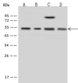 MINA / MINA53 Antibody - Anti-MINA rabbit polyclonal antibody at 1:500 dilution. Lane A: A431 Whole Cell Lysate. Lane B: Raji Whole Cell Lysate. Lane C: Jurkat Whole Cell Lysate. Lane D: HeLa Whole Cell Lysate. Lysates/proteins at 30 ug per lane. Secondary: Goat Anti-Rabbit IgG (H+L)/HRP at 1/10000 dilution. Developed using the ECL technique. Performed under reducing conditions. Predicted band size: 53 kDa. Observed band size: 53 kDa.