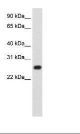 MINA / MINA53 Antibody - Fetal Thymus Lysate.  This image was taken for the unconjugated form of this product. Other forms have not been tested.