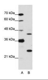 MINA / MINA53 Antibody - A: Marker, B: HepG2 Cell Lysate.  This image was taken for the unconjugated form of this product. Other forms have not been tested.