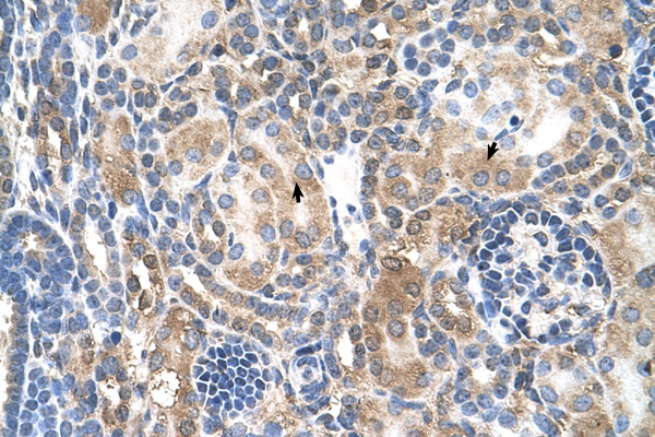 Mineralocorticoid Receptor Antibody - NR3C2 antibody ARP45599_T100-NP_000892-NR3C2(nuclear receptor subfamily 3, group C, member 2) Antibody IHC of formalin-fixed, paraffin-embedded human Kidney. Positive label: Epithelial cells of renal tubule indicated with arrows. Antibody concentration 4-8 ug/ml. Magnification 400X.  This image was taken for the unconjugated form of this product. Other forms have not been tested.