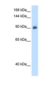 Mineralocorticoid Receptor Antibody - NR3C2 antibody ARP45599_T100-NP_000892-NR3C2(nuclear receptor subfamily 3, group C, member 2) Antibody Western blot of A172 cell lysate.  This image was taken for the unconjugated form of this product. Other forms have not been tested.