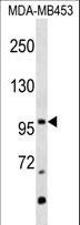 Mineralocorticoid Receptor Antibody - NR3C2 Antibody western blot of MDA-MB453 cell line lysates (35 ug/lane). The NR3C2 antibody detected the NR3C2 protein (arrow).
