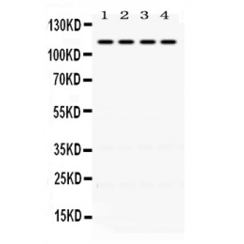 Mineralocorticoid Receptor Antibody - NR3C2 antibody Western blot. All lanes: Anti NR3C2 at 0.5 ug/ml. Lane 1: Rat Kidney Tissue Lysate at 50 ug. Lane 2: Mouse Kidney Tissue Lysate at 50 ug. Lane 3: HELA Whole Cell Lysate at 40 ug. Lane 4: A431 Whole Cell Lysate at 40 ug. Predicted band size: 110 kD. Observed band size: 110 kD.