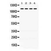 Mineralocorticoid Receptor Antibody - NR3C2 antibody Western blot. All lanes: Anti NR3C2 at 0.5 ug/ml. Lane 1: Rat Kidney Tissue Lysate at 50 ug. Lane 2: Mouse Kidney Tissue Lysate at 50 ug. Lane 3: HELA Whole Cell Lysate at 40 ug. Lane 4: A431 Whole Cell Lysate at 40 ug. Predicted band size: 110 kD. Observed band size: 110 kD.