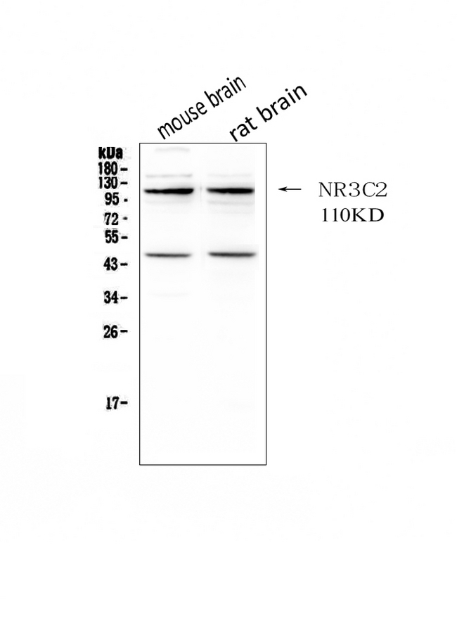 Mineralocorticoid Receptor Antibody - Western blot analysis of NR3C2 using anti-NR3C2 antibody. Electrophoresis was performed on a 5-20% SDS-PAGE gel at 70V (Stacking gel) / 90V (Resolving gel) for 2-3 hours. The sample well of each lane was loaded with 50ug of sample under reducing conditions. Lane 1: mouse brain tissue lysates, Lane 2: rat brain tissue lysates. After Electrophoresis, proteins were transferred to a Nitrocellulose membrane at 150mA for 50-90 minutes. Blocked the membrane with 5% Non-fat Milk/ TBS for 1.5 hour at RT. The membrane was incubated with rabbit anti-NR3C2 antigen affinity purified polyclonal antibody at 0.5 µg/mL overnight at 4°C, then washed with TBS-0.1% Tween 3 times with 5 minutes each and probed with a goat anti-rabbit IgG-HRP secondary antibody at a dilution of 1:10000 for 1.5 hour at RT. The signal is developed using an Enhanced Chemiluminescent detection (ECL) kit with Tanon 5200 system. A specific band was detected for NR3C2 at approximately 110KD. The expected band size for NR3C2 is at 110KD.