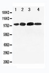 Mineralocorticoid Receptor Antibody - WB of Mineralocorticoid Receptor antibody. All lanes: Anti-NR3C2 at 0.5ug/ml. Lane 1: 293T Whole Cell Lysate at 40ug. Lane 2: SMMC Whole Cell Lysate at 40ug. Lane 3: SW620 Whole Cell Lysate at 40ug. Lane 4: HELA Whole Cell Lysate at 40ug. Predicted bind size: 107KD. Observed bind size: 100KD.