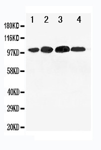 Mineralocorticoid Receptor Antibody - WB of Mineralocorticoid Receptor antibody. All lanes: Anti-NR3C2 at 0.5ug/ml. Lane 1: 293T Whole Cell Lysate at 40ug. Lane 2: SMMC Whole Cell Lysate at 40ug. Lane 3: SW620 Whole Cell Lysate at 40ug. Lane 4: HELA Whole Cell Lysate at 40ug. Predicted bind size: 107KD. Observed bind size: 100KD.