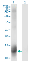 Mineralocorticoid Receptor Antibody - Western Blot analysis of NR3C2 expression in transfected 293T cell line by NR3C2 monoclonal antibody (M01), clone 2B5.Lane 1: NR3C2 transfected lysate (Predicted MW: 12.21 KDa).Lane 2: Non-transfected lysate.