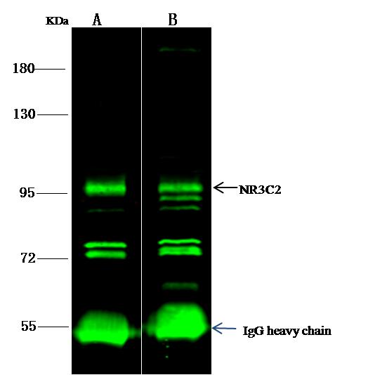 Mineralocorticoid Receptor Antibody - NR3C2 was immunoprecipitated using: Lane A: 0.5 mg Hela Whole Cell Lysate. Lane B: 0.5 mg 293T Whole Cell Lysate. 4 uL anti-NR3C2 rabbit polyclonal antibody and 15 ul of 50% Protein G agarose. Primary antibody: Anti-NR3C2 rabbit polyclonal antibody, at 1:100 dilution. Secondary antibody: Dylight 800-labeled antibody to rabbit IgG (H+L), at 1:5000 dilution. Developed using the odssey technique. Performed under reducing conditions. Predicted band size: 107 kDa. Observed band size: 107 kDa.