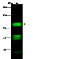 Mineralocorticoid Receptor Antibody - Anti-NR3C2 rabbit polyclonal antibody at 1:500 dilution. Lane A: MCF7 Whole Cell Lysate. Lysates/proteins at 30 ug per lane. Secondary: Goat Anti-Rabbit IgG H&L (Dylight 800) at 1/10000 dilution. Developed using the Odyssey technique. Performed under reducing conditions. Predicted band size: 107 kDa. Observed band size: 107 kDa. (We are unsure as to the identity of these extra bands.)
