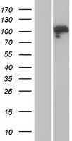 Mineralocorticoid Receptor Protein - Western validation with an anti-DDK antibody * L: Control HEK293 lysate R: Over-expression lysate