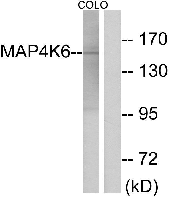 MINK1 / MINK Antibody - Western blot analysis of lysates from COLO cells, using MAP4K6 Antibody. The lane on the right is blocked with the synthesized peptide.