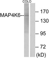 MINK1 / MINK Antibody - Western blot analysis of lysates from COLO cells, using MAP4K6 Antibody. The lane on the right is blocked with the synthesized peptide.