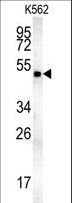 MINPP1 Antibody - MINPP1 Antibody western blot of K562 cell line lysates (35 ug/lane). The MINPP1 antibody detected the MINPP1 protein (arrow).