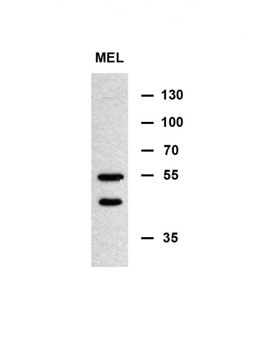 MINPP1 Antibody - MINPP1 Antibody western blot of murine erythroleukemia cell line lysates (35 ug/lane). The MINPP1 antibody detected the MINPP1 protein (arrow). (Kindly offered by Doc. Normal)