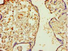MINPP1 Antibody - Immunohistochemistry of paraffin-embedded human placenta tissue using antibody at 1:100 dilution.  This image was taken for the unconjugated form of this product. Other forms have not been tested.