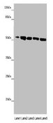 MINPP1 Antibody - Western blot All lanes: MINPP1 antibody at 14µg/ml Lane 1: Jurkat whole cell lysate Lane 2: U251 whole cell lysate Lane 3: K562 whole cell lysate Lane 4: Hela whole cell lysate Lane 5: HepG2 whole cell lysate Secondary Goat polyclonal to rabbit IgG at 1/10000 dilution Predicted band size: 56, 35, 32, 34 kDa Observed band size: 56 kDa