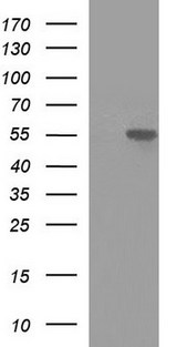 MINPP1 Antibody - HEK293T cells were transfected with the pCMV6-ENTRY control (Left lane) or pCMV6-ENTRY MINPP1 (Right lane) cDNA for 48 hrs and lysed. Equivalent amounts of cell lysates (5 ug per lane) were separated by SDS-PAGE and immunoblotted with anti-MINPP1.