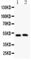 MIP / AQP0 / Aquaporin 0 Antibody - anti-MIP antibody, Western blotting All lanes: Anti MIP at 0.5ug/ml Lane 1: Mouse Spleen Tissue Lysate at 50ugLane 2: Mouse Intestine Tissue Lysate at 50ugPredicted bind size: 28KD Observed bind size: 50KD