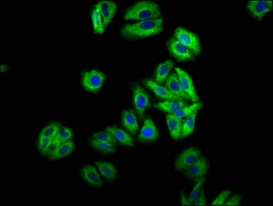 MIP / AQP0 / Aquaporin 0 Antibody - Immunofluorescence staining of HepG2 cells at a dilution of 1:66, counter-stained with DAPI. The cells were fixed in 4% formaldehyde, permeabilized using 0.2% Triton X-100 and blocked in 10% normal Goat Serum. The cells were then incubated with the antibody overnight at 4 °C.The secondary antibody was Alexa Fluor 488-congugated AffiniPure Goat Anti-Rabbit IgG (H+L) .