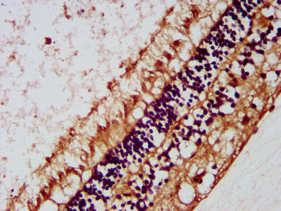 MIP / AQP0 / Aquaporin 0 Antibody - Immunohistochemistry image at a dilution of 1:200 and staining in paraffin-embedded human eye tissue performed on a Leica BondTM system. After dewaxing and hydration, antigen retrieval was mediated by high pressure in a citrate buffer (pH 6.0) . Section was blocked with 10% normal goat serum 30min at RT. Then primary antibody (1% BSA) was incubated at 4 °C overnight. The primary is detected by a biotinylated secondary antibody and visualized using an HRP conjugated SP system.