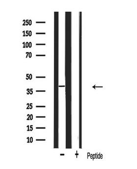 MIP / AQP0 / Aquaporin 0 Antibody - Western blot analysis of AQP0 antibody expression in mouse eye tissue lysates. The lane on the right is treated with the antigen-specific peptide.