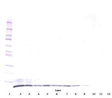 MIP2 / GRO2 / CXCL2 Antibody - Biotinylated Anti-Human GRO-ß (CXCL2) Western Blot Reduced